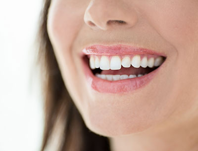 Porcelain Veneers Cost And Faqs Las Vegas Nv How Much Do Porcelain Veneers Cost