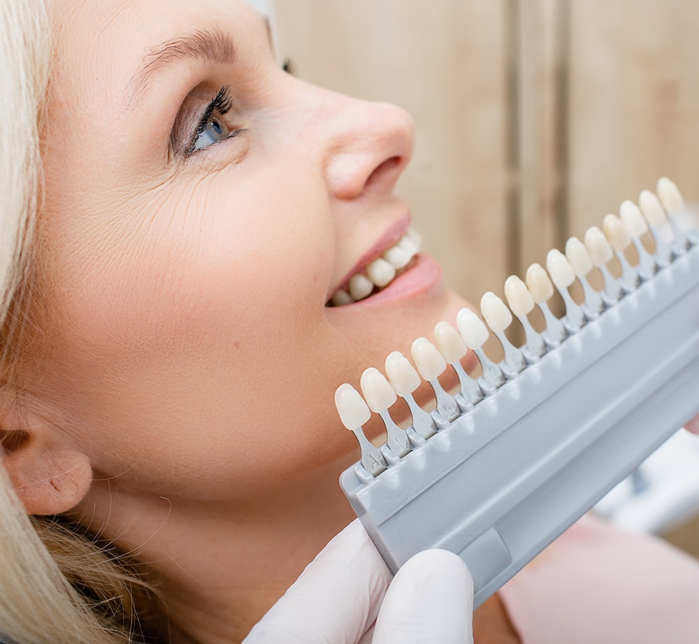 Teeth palette with different shades of teeth near female smiling. Stomatology, whitening teeth, tooth implant, veneers, crowns, and dentures