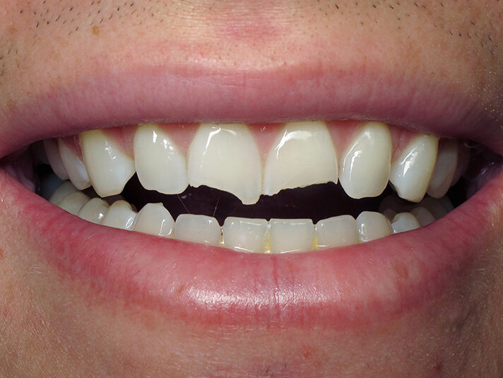 Before
